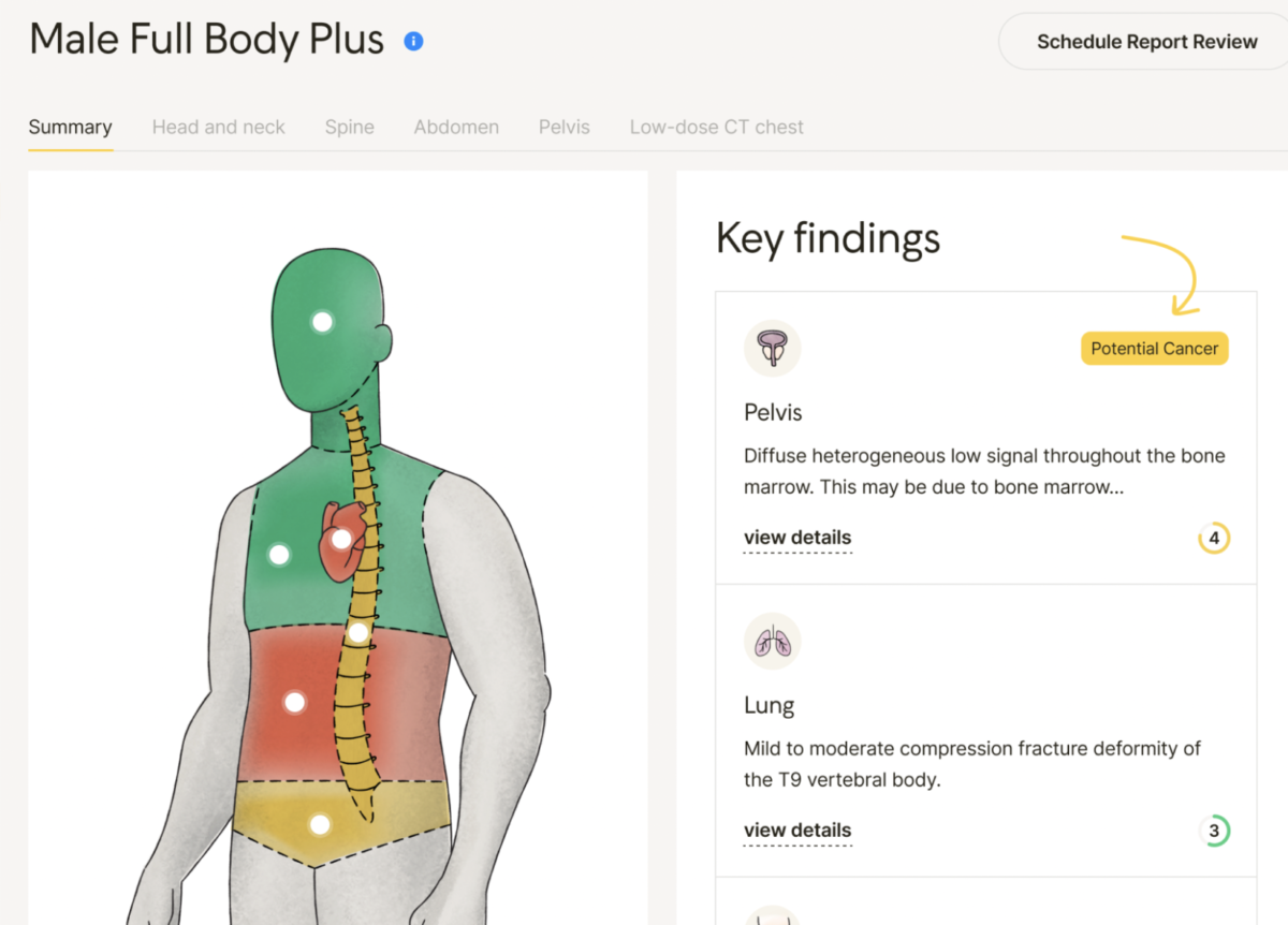 Image of MyEzra Patient interface