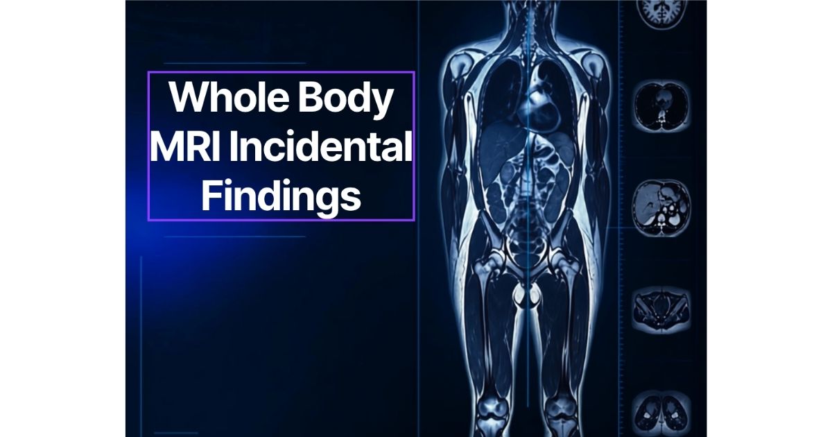 Whole Body MRI Incidental Findings