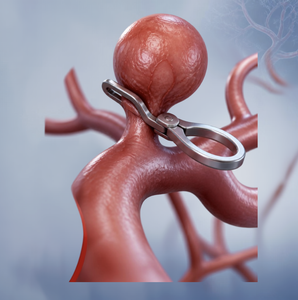 Aneurysm clip